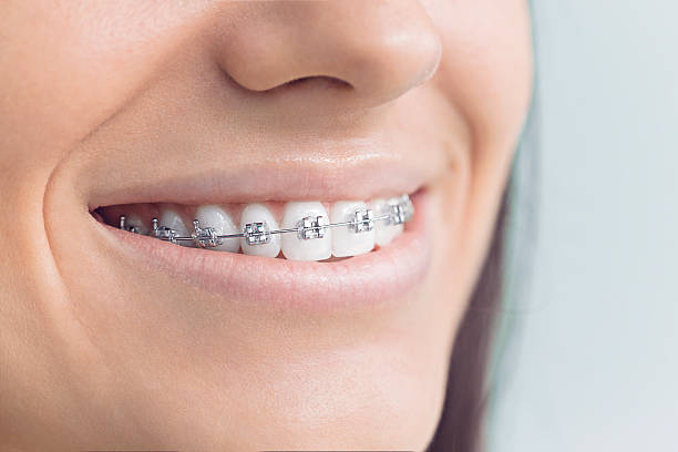 Dental Inlays and Onlays in Gulf Hills, MS